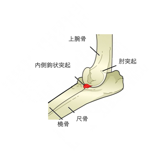 犬の前十字靭帯損傷模式図