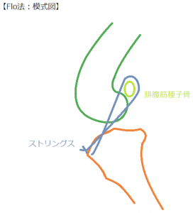 Flo法。犬の前十字靭帯損傷の治療（手術）方法。