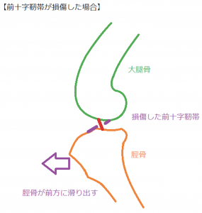 犬の前十字靭帯損傷_犬模式図③